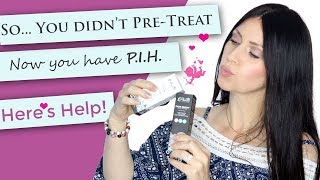 How to treat Perioral Dermatitis Dermatologist Explains [upl. by Phila745]