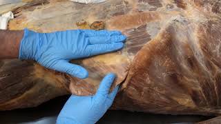 Anterior Abdominal Wall Muscles and the Abdominal Aponeurosis [upl. by Otreblasiul]