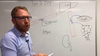 Type 2 Diabetes Pathophysiology [upl. by Eob]