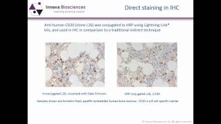 Immunohistochemistry Webinar An Introduction to Immunohistochemistry [upl. by Annanhoj194]