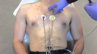 12 Lead ECG Placement example [upl. by Panta339]