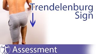 Trendelenburg Sign  Hip Abductor Weakness [upl. by Nohtanhoj]