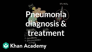 Pneumonia diagnosis and treatment  Respiratory system diseases  NCLEXRN  Khan Academy [upl. by Cousins295]