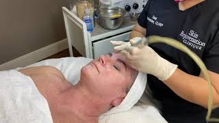 Microdermabrasion Facial Demonstration [upl. by Breanne]