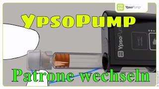 YpsoPump Patrone wechseln Insulinpumpe mylife Diabetescare 08 [upl. by Windham]