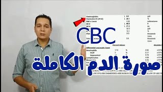 CBC ازاى تقرا تحليل صورة الدم الكاملة [upl. by Pylle]