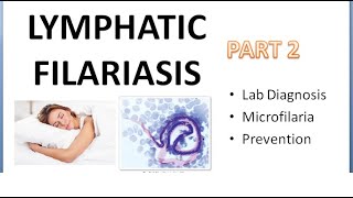 PSM 290 Lymphatic Filariasis Part 2 Lab Diagnosis Microfilaria Prevention DEC Provocation Test [upl. by Lal554]