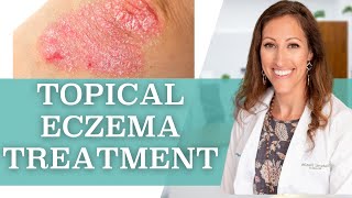 How to Treat Eczema Topically at Home [upl. by Ylim103]