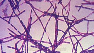 Anthrax and Bacillus anthracis [upl. by Haman716]