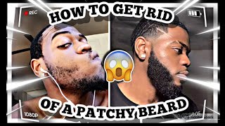 HOW TO FIX A PATCHY BEARD  PATCHY BEARD SOLUTION [upl. by Jan]