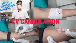 Important tips and tricks for IV cannulation [upl. by Mesics]