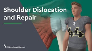 Traumatic Knee Dislocation ReductionQuick Version [upl. by Eihcra]