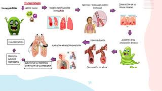 Bronquiolitis parte 1FisiopatologíaPediatría [upl. by Toor]