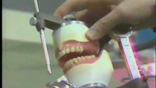 Posterior Teeth  Balanced Occlusion [upl. by Mann]