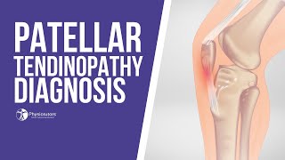 How to Diagnose Patellar Tendinopathy  Jumpers Knee Diagnosis [upl. by Yrkcaz]