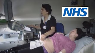 What happens at a scan and what will they tell me  NHS [upl. by Ellennod]