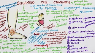 Squamous Cell Carcinoma  Pathology [upl. by Bainbrudge]