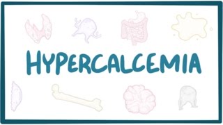 What is a Coronary Calcium Score [upl. by Erdreid]