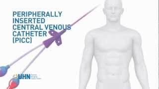 Learn About the Peripherally Inserted Central Venous Catheter PICC [upl. by Solegna]