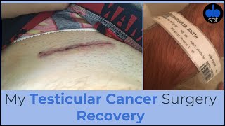 My Testicular Cancer Surgery Recovery [upl. by Jaddan]