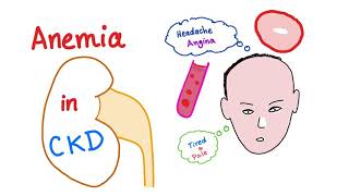 Anemia in Chronic Kidney Disease [upl. by Brendan219]