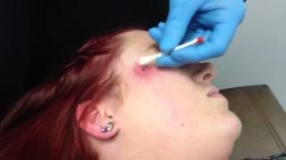 Dermal Piercing on cheek [upl. by Geithner531]