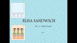 Méthode ELISA sandwich [upl. by Sapers]