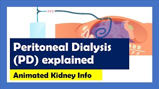 Peritoneal Dialysis explained [upl. by Liana590]