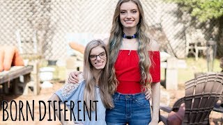 My Identical Twin With Dwarfism  BORN DIFFERENT [upl. by Abekam]