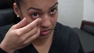 How to Apply Ointment to the Eyes and Eyelids [upl. by Wey]