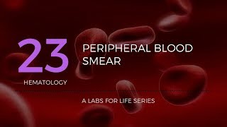 Part 1  Preparation of Peripheral Blood Smear PBS [upl. by Eleonora]