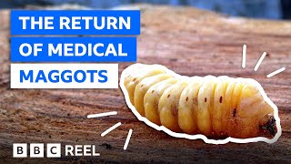 Why maggots are a medical marvel – BBC REEL [upl. by Shiau]