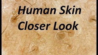 A Closer Look At Human Skin Under Microscope [upl. by Attesoj]