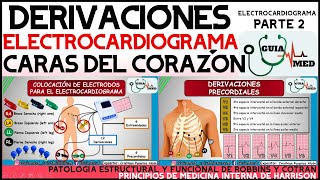 Analisis Onda Espectral Arterias Carótidas y Vertebrales [upl. by Idolah]