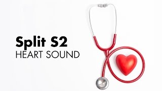 Fixed Split S2  Heart Sounds  MEDZCOOL [upl. by Noval]