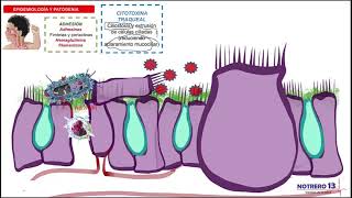 Bordetella pertussis Patogenia de la Tos Ferina [upl. by Bernardo]