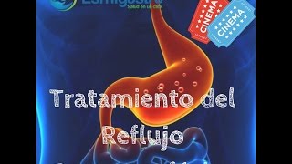 Tratamiento del Reflujo Gastroesofágico [upl. by Nihcas]