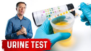 Urine Test Simplified [upl. by Panta]