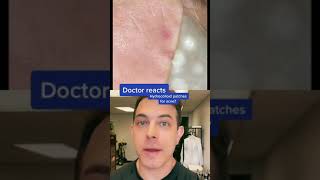 Do hydrocolloid patches work Dermatologist answers  208SkinDoc [upl. by Rosane]