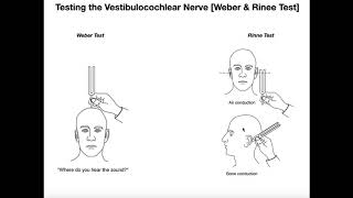 Interpreting the WeberRinne Tests EXPLAINED [upl. by Ithsav]