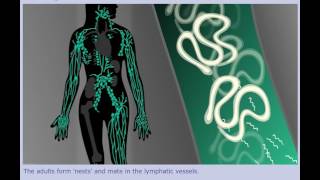 Lymphatic Filariasis Elephantiasis  Life Cycle [upl. by Quillon927]