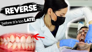 How To Treat Gum Disease [upl. by Einnod]