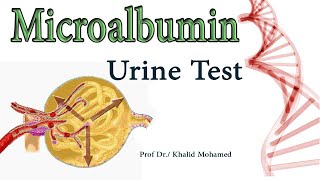 Microalbumin MA Urine Albumin Albumin to Creatinine Ratio [upl. by Akinorev]