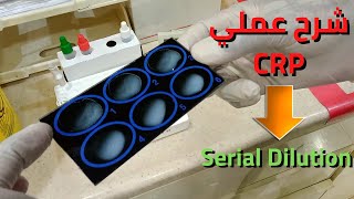 شرح عملي لفحص CRPPractical explanation of CRP examinationserial dilution [upl. by Ettessil]