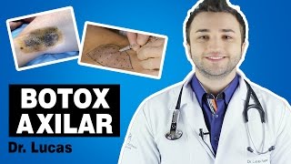 Saiba tudo sobre Botox Axilar para hiperidrose axilar [upl. by Aiderfla368]