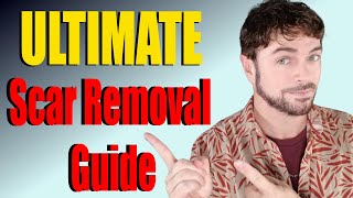 Scar Removal Products That Work  ULTIMATE Product Guide  Chris Gibson [upl. by Cornish694]