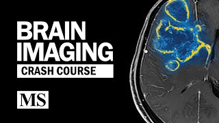 Brain Imaging Crash Course [upl. by Rexana]