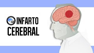 Paracetamol ibuprofeno Nolotil ¿De verdad sabes qué tomar cuando algo te duele [upl. by Valentina]