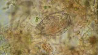 Rotifer under the microscope [upl. by Sonni]