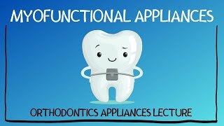 Myofunctional Appliances in Orthodontics  Dr Manase [upl. by Birck]